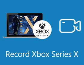 Xbox Series X rögzítése