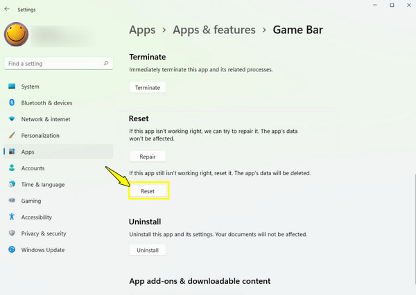 إعادة تعيين شريط ألعاب Xbox